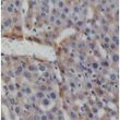 Pentoxifylline (PTX) attenuates LPS-induced acute liver injury via effects on ICAM-1 expression