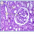 Potential activity of GIT-27 against renal ischemia reperfusion injury: an experimental study in male rats